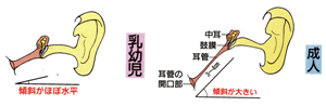 乳幼児と成人の耳管の構造